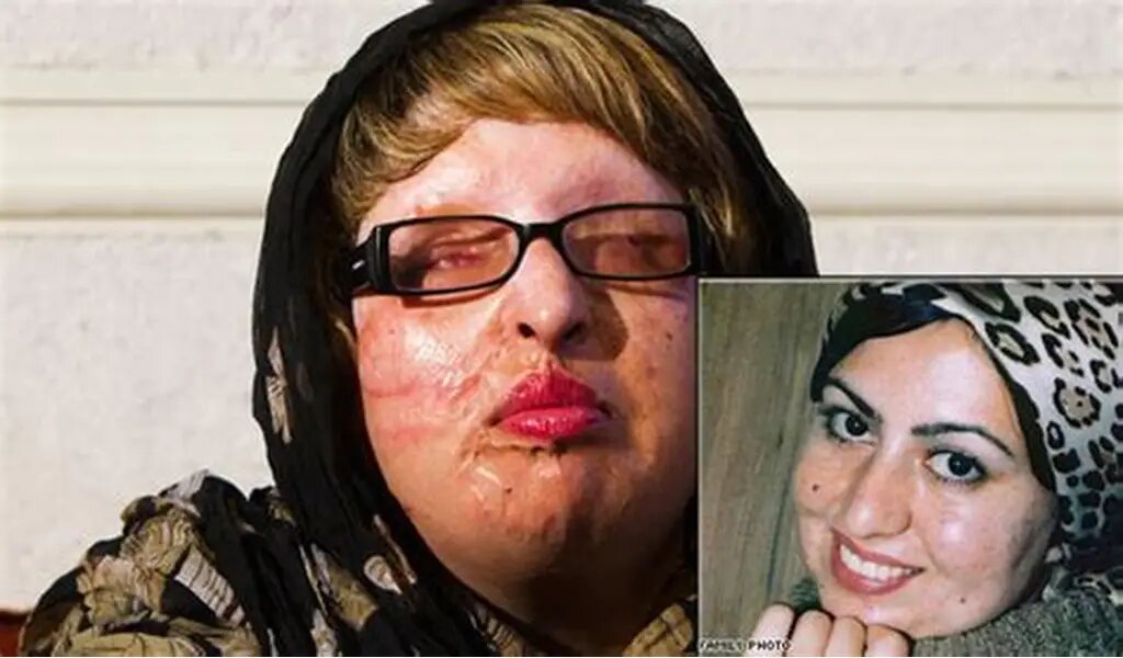 از آمنه بهرامی تا شیدا کاردگر؛ خشونت علیه زنان/ قتل و اسیدپاشی به دلیل «نه گفتن»