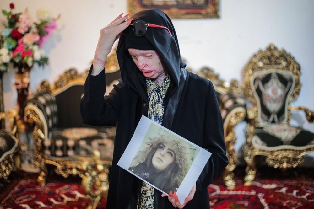 از آمنه بهرامی تا شیدا کاردگر؛ خشونت علیه زنان/ قتل و اسیدپاشی به دلیل «نه گفتن»