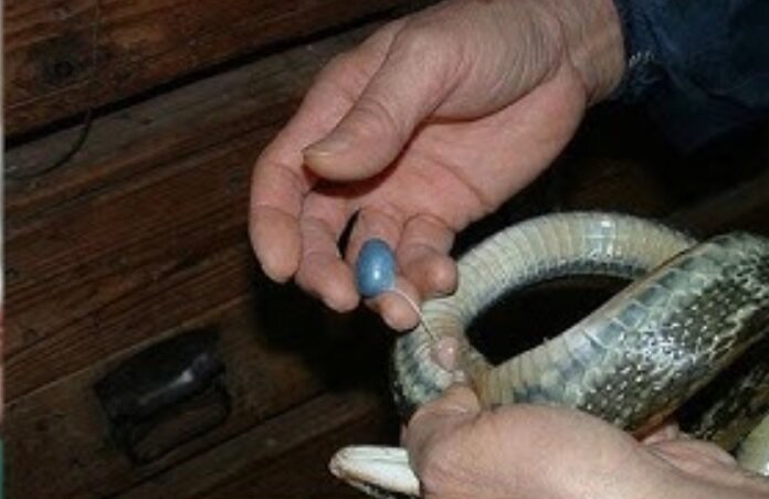 خارج کردن کرم ۱۸ سانتی‌متری از مغز یک مرد/ عکس