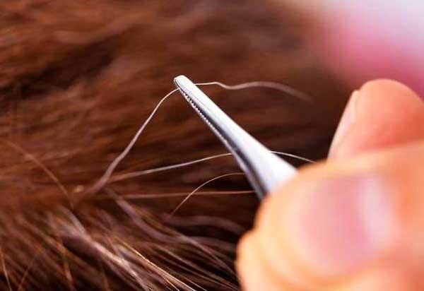 آیا می‌توان جلوی سفید شدن موها را گرفت؟/ دلیل سفیدی مو در نواحی شقیقه‌ها چیست؟/ چه دارو و مکملی اثر قطعی بر رفع سفیدی مو دارد؟