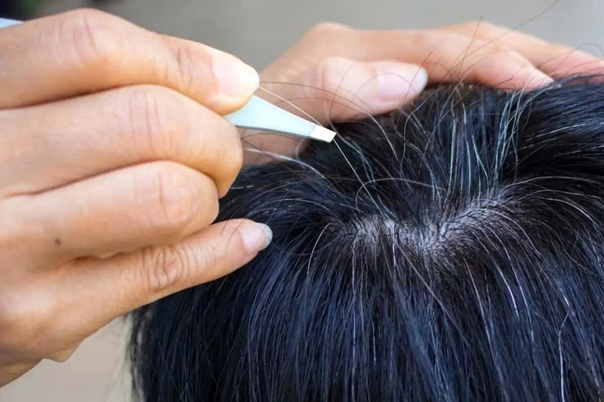 آیا می‌توان جلوی سفید شدن موها را گرفت؟/ دلیل سفیدی مو در نواحی شقیقه‌ها چیست؟/ چه دارو و مکملی اثر قطعی بر رفع سفیدی مو دارد؟