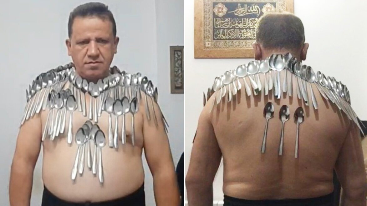 عجیب ترین رکوردهای گینس ۲۰۲۵؛ از نگه داشتن چوب کبریت در بینی تا خوک اسکیت‌باز