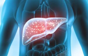 چگونه متوجه نارسایی کبد شویم؟ دلیل زرد شدن سفیدی چشم چیست؟