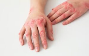 بیمار درمان نشدنی هنرپیشه معروف چیست؟ بیمار درمان نشدنی هنرپیشه معروف چیست؟