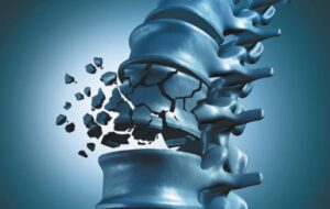 مصرف این میوه مانع پوکی استخوان می‌شود