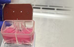 «چیپ معجزه‌گر» سرطان؛ فناوری جدید پیش‌بینی می‌کند درمان جواب می‌دهد یا نه