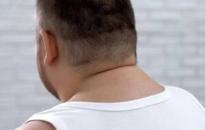 اندازه گردن چه چیزی در مورد سلامتی شما می‌گوید؟