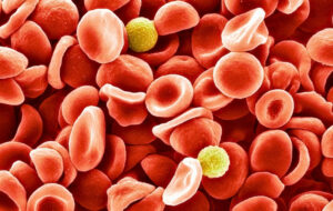 دانشمندان «نادرترین» گروه خونی جهان را شناسایی کردند! دانشمندان «نادرترین» گروه خونی جهان را شناسایی کردند!