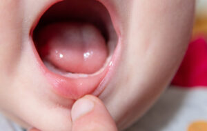 کشف نشانه‌ای عجیب از پیری زودهنگام در کودکان