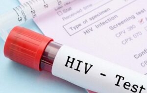 انتقال ایدز با روابط جنسی ۶۴درصد شد؛ برای تست سریع و محرمانه به این پایگاه‌ها مراجعه کنید