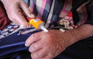 ماجرای رها شدن یک نوزاد پروانه‌ای در بیمارستان