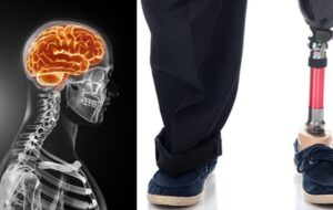 ماجرای مردی که از پزشکان خواست دو انگشتش را قطع کنند